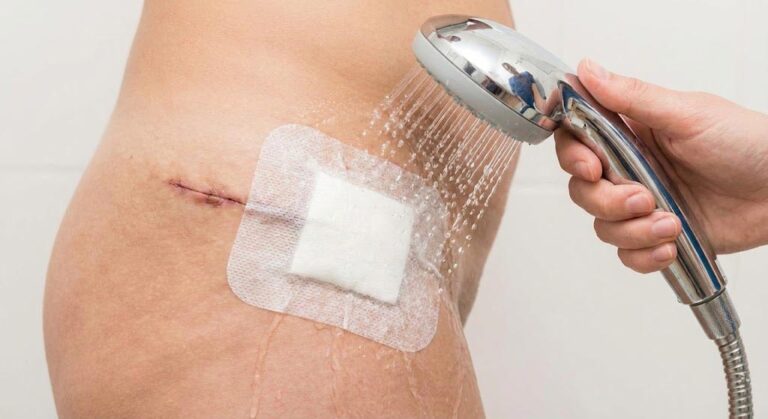 Wound-care-during-showering